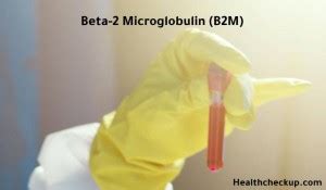Beta 2 Microglobulin (B2M) Blood Test: Low, High, Normal Levels.